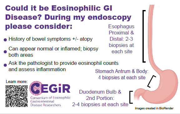 CEGIR EGD Passport Card.