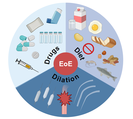CEGIR figure showing drugs, diet and dilation.